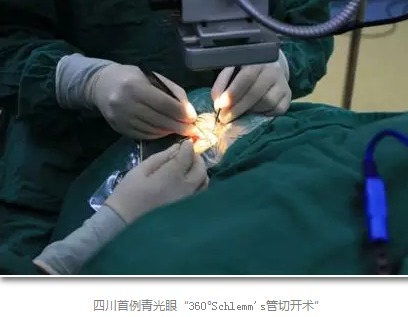 成都金沙澳门(中国)唯一官方网站已经开展的青光眼手术有:引流阀 (钉)植入手术(2015年以来已200多 ),360°Schlemm's管切开术,激光CO2 辅助巩膜深层切除术,小梁切除术青(光眼)白(内障)联合手术。还有虹膜周切术、前房成形术、 虹膜复位术,睫状体冷冻术,小梁切开术和前房穿刺术等6.png 成都金沙澳门(中国)唯一官方网站已经开展的青光眼手术有:引流阀 (钉)植入手术(2015年以来已200多 ),360°Schlemm's管切开术,激光CO2 辅助巩膜深层切除术,小梁切除术青(光眼)白(内障)联合手术。还有虹膜周切术、前房成形术、 虹膜复位术,睫状体冷冻术,小梁切开术和前房穿刺术等6.png