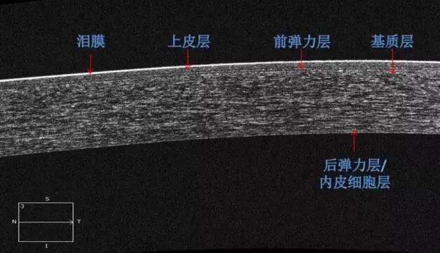 金沙澳门(中国)唯一官方网站课堂：后节频域OCT前节模块的运用2.jpg