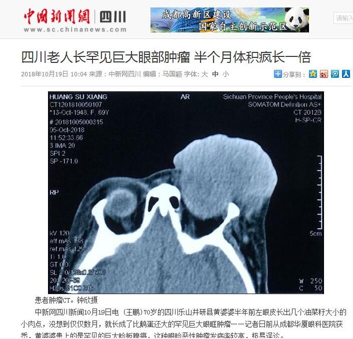 媒体看金沙澳门(中国)唯一官方网站之成都金沙澳门(中国)唯一官方网站2018年新闻媒体报道集锦13.jpg