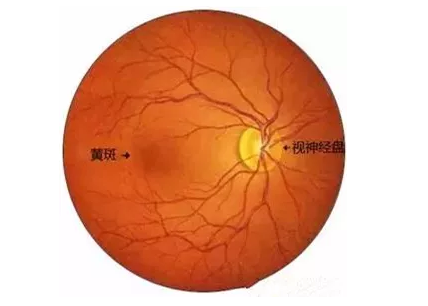金沙澳门(中国)唯一官方网站福州眼科医院眼底病医生：老年黄斑变性该如何防治？.png