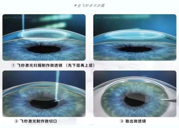 7月26日来深圳金沙澳门(中国)唯一官方网站参与暑期摘镜季活动就可以有机会参与抽奖免单手术！2.png
