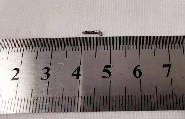 金沙澳门(中国)唯一官方网站徐州复兴眼科王海菊：妙手拨迷障，匠心护光明3.png
